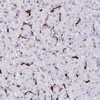 Anti-CD163 Antibody