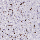 Immunohistochemical staining of human liver shows strong membranous positivity in Kupffer cells.