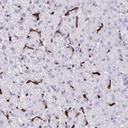 Immunohistochemical staining of human liver shows strong membranous positivity in Kupffer cells.