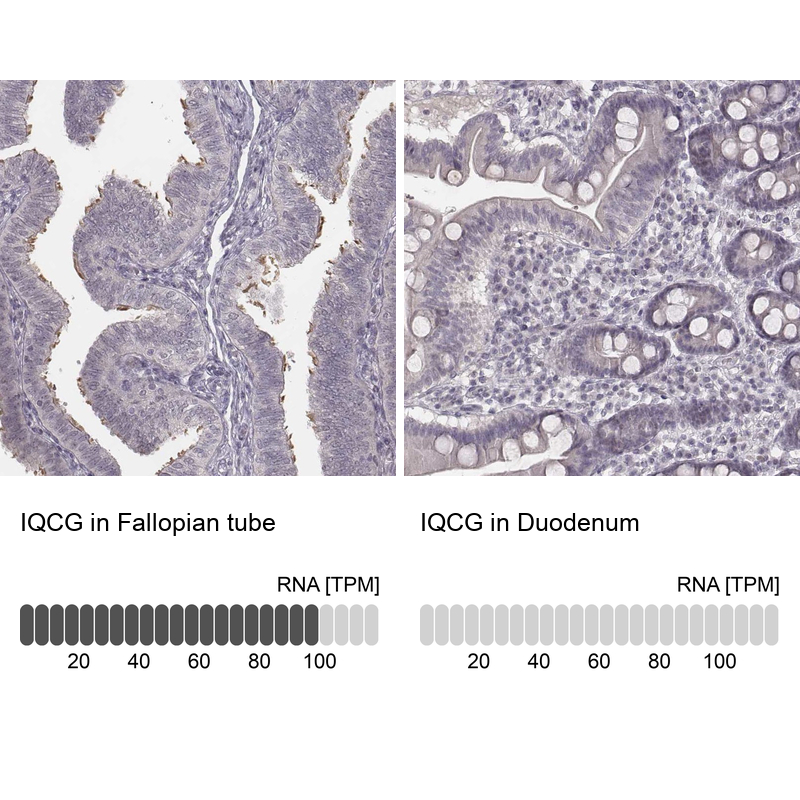 Anti-IQCG Antibody
