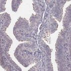 Immunohistochemical staining of human fallopian tube shows high expression.
