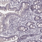 Immunohistochemical staining of human duodenum shows low expression as expected.