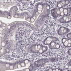 Immunohistochemical staining of human duodenum shows low expression as expected.