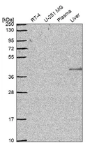 Western blot analysis in human cell line RT-4, human cell line U-251 MG, human plasma and human liver tissue.