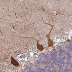 Immunohistochemical staining of human cerebellum shows strong cytoplasmic positivity in Purkinje cells and processes.