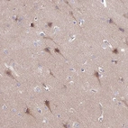 Immunohistochemical staining of human cerebral cortex shows moderate cytoplasmic positivity in neuronal cells and neuropil.