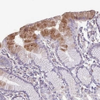 Immunohistochemical staining of human stomach shows moderate cytoplasmic positivity in glandular cells in superficial mucosa.