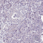 Immunohistochemical staining of human pancreas shows no cytoplasmic positivity in exocrine glandular cells and Islets of Langerhans as expected.