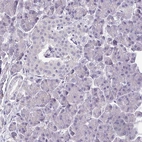Immunohistochemical staining of human pancreas shows no cytoplasmic positivity in exocrine glandular cells and Islets of Langerhans as expected.