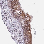 Anti-ZCCHC5 Antibody