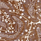 Anti-MAP2K2 Antibody