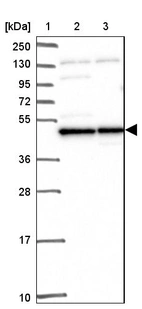 Lane 1: Marker [kDa] 250, 130, 95, 72, 55, 36, 28, 17, 10_br/_Lane 2: Human cell line RT-4_br/_Lane 3: Human cell line U-251 MG