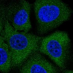 Immunofluorescent staining of human cell line MCF7 shows localization to cytosol.