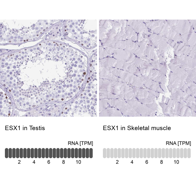 Anti-ESX1 Antibody