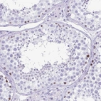 Immunohistochemical staining of human testis shows high expression.