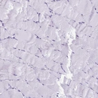Immunohistochemical staining of human skeletal muscle shows low expression as expected.