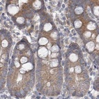 Immunohistochemical staining of human small intestine using Anti-RPL32 antibody HPA051994.