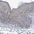 Immunohistochemical staining of human skin using Anti-RPL32 antibody HPA051994.