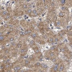 Immunohistochemical staining of human liver using Anti-RPL32 antibody HPA051994.