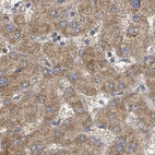 Immunohistochemical staining of human liver using Anti-RPL32 antibody HPA051994.