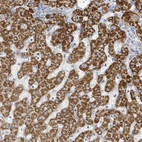 Immunohistochemical staining of human liver shows strong granular cytoplasmic positivity in hepatocytes.