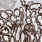 Immunohistochemical staining of human kidney shows strong granular cytoplasmic positivity in cells in tubules.