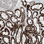 Anti-SUCLG2 Antibody