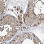 Immunohistochemical staining of human testis shows moderate granular cytoplasmic positivity in Leydig cells.