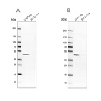 Western blot analysis using Anti-SUCLG2 antibody HPA051998 (A) shows similar pattern to independent antibody HPA046705 (B).