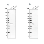 Western blot analysis using Anti-SUCLG2 antibody HPA051998 (A) shows similar pattern to independent antibody HPA046705 (B).