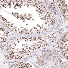 Anti-PARP2 Antibody