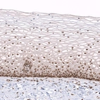 Immunohistochemical staining of human cervix shows moderate to strong nuclear positivity in squamous epithelial cells.
