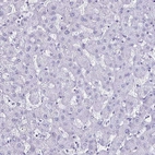 Immunohistochemical staining of human liver shows no positivity in hepatocytes as expected.