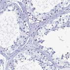 Immunohistochemical staining of human testis shows weak to moderate nuclear positivity in cells in seminiferous ducts.