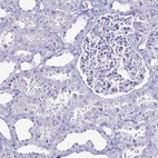 Immunohistochemical staining of human kidney shows no positivity in cells in tubules as expected.