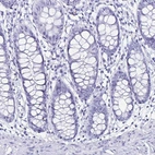 Immunohistochemical staining of human colon shows no positivity in glandular cells as expected.