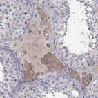 Immunohistochemical staining of human testis shows moderate cytoplasmic positivity in Leydig cells.