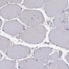Immunohistochemical staining of human skeletal muscle shows no positivity in myocytes as expected.
