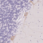 Anti-PNLIPRP3 Antibody