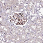 Anti-LMO7DN Antibody
