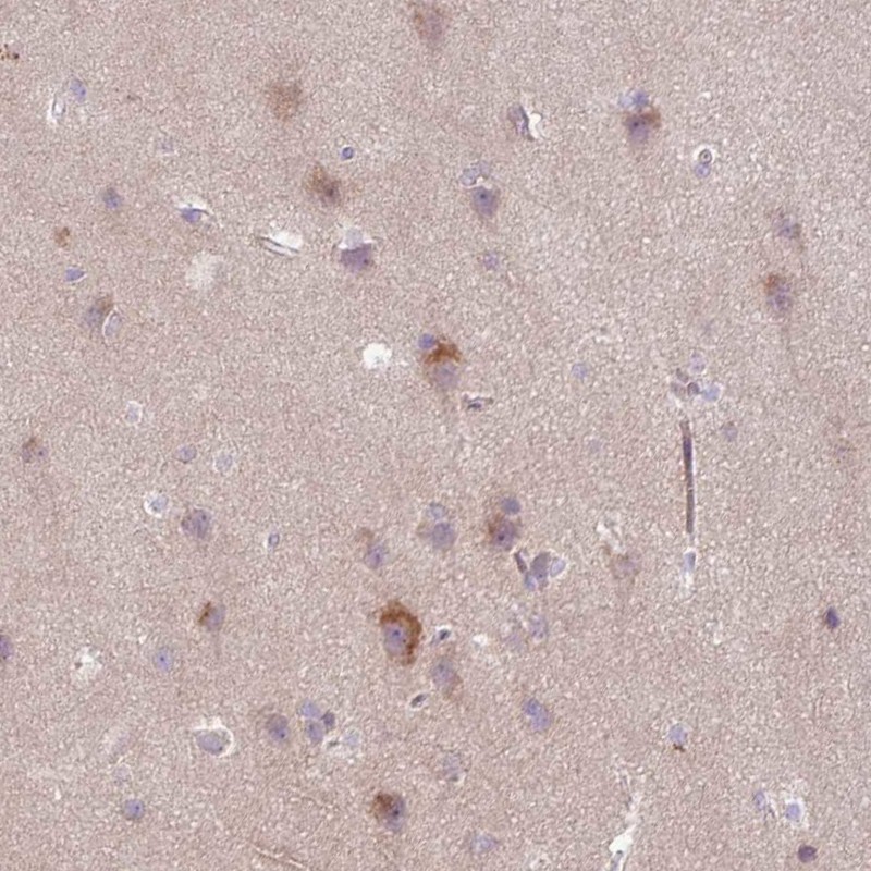 Anti-ARHGEF25 Antibody