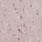 Anti-ARHGEF25 Antibody