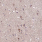 Anti-ARHGEF25 Antibody