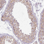 Anti-PNLDC1 Antibody