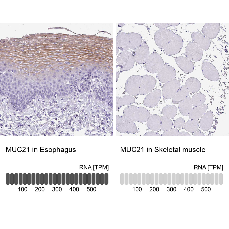 Anti-MUC21 Antibody