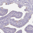 Immunohistochemical staining of human fallopian tube shows moderate membranous positivity in glandular cells.
