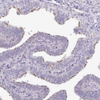 Immunohistochemical staining of human fallopian tube shows moderate membranous positivity in glandular cells.