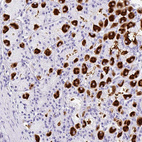 Anti-MUC21 Antibody