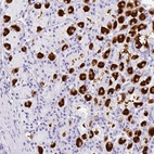 Immunohistochemical staining of human stomach shows strong cytoplasmic positivity in parietal cells.