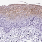 Immunohistochemical staining of human esophagus shows moderate membranous positivity in squamous epithelial cells.